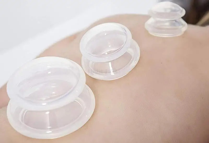Schmerz- & Faszienlösende Massage Schröpfe | Einzeln