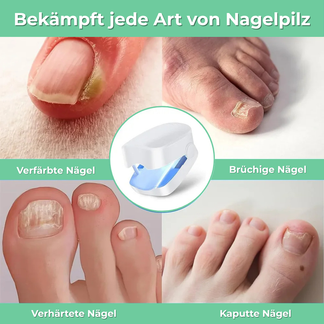 NagelRein™